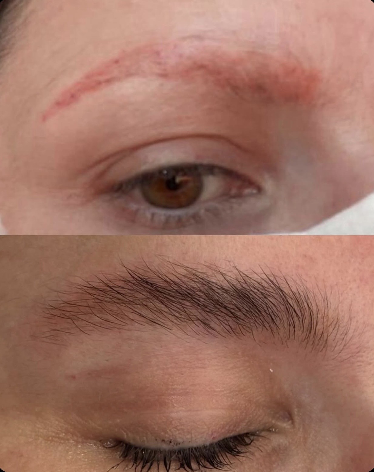 Avant/après ExoBrows, cas cliente 1