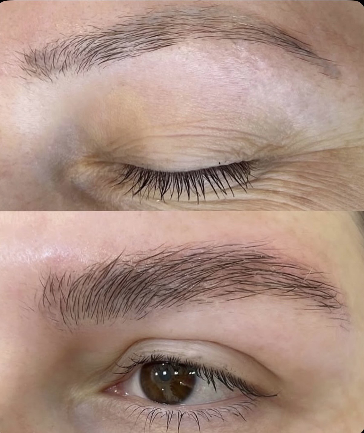 Avant/après ExoBrows, cas cliente 3