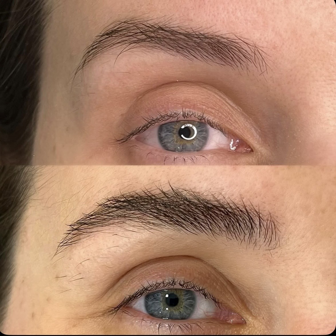 Avant/après ExoBrows, cas cliente 4