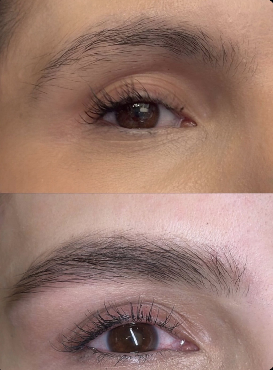 Gros plan sourcils, résultat ExoBrows